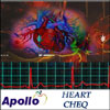 Apollo Heart Cheq - Click here to View more details about this Product